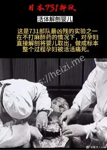 731把活人解剖做标本