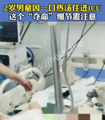 儿童热汤烫伤急救